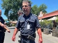 Constable Edwards says the attack had a significant impact on him both physically and psychologically. Picture: Supplied.