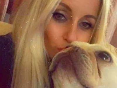 Mum loses hands after being bitten by dog. Picture: Facebook.