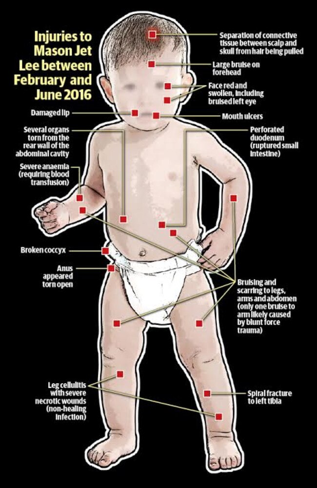 Autopsy examinations conducted on Mason revealed that he had been severely mistreated for some time before his death.