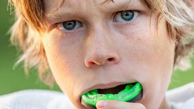 The current recommendation of 12 days post-concussion may not be sufficient to allow full recovery, experts say.