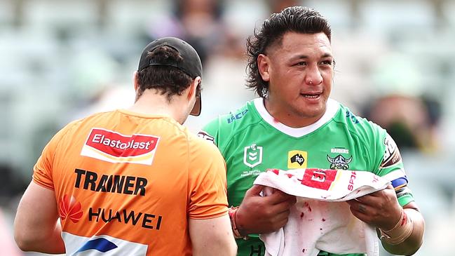 Josh Papalii of the Raiders receives attention from the trainer for a bleeding nose during the Round 19 NRL match between the Canberra Raiders and the New Zealand Warriors at GIO Stadium.