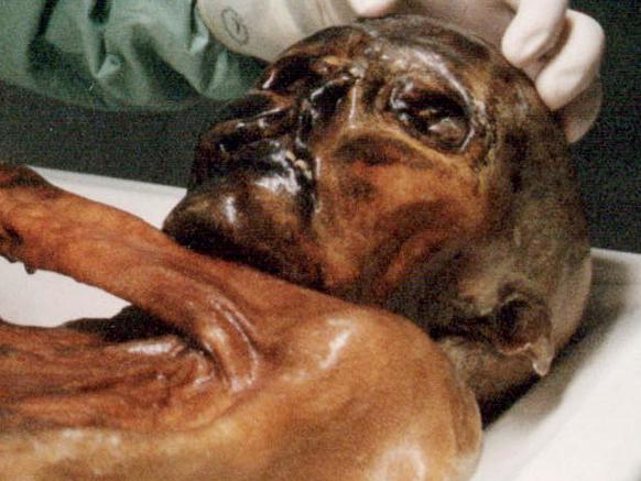 A researcher prepares to take samples of the 5,300yr-old mummy known as Oetzi (otzi) in this pic released by the /South /Tyrol Archaeology /Museum in /Bolzano, /Italy, 25/9/00. The Bronze Age hunter is the oldest and best preserved frozen mummy in the world. The project is aimed at identifying the origins and the migration patterns of the mummy. (AP Pic/Augustin Ochsenreiter/HO) science ancient history