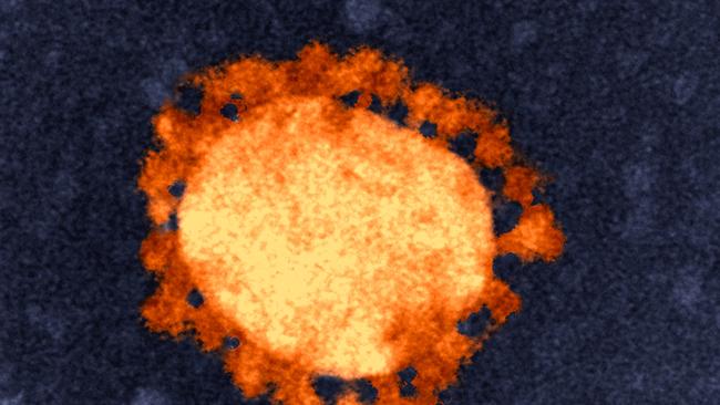 An image of the corona virus responsible for causing the disease COVID-19. Provided by  CSIRO's Australian Animal Health Laboratory in Geelong. Picture: CSIRO