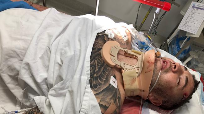 Manly star Joel Thompson in hospital after falling and hitting his head. Picture: Supplied