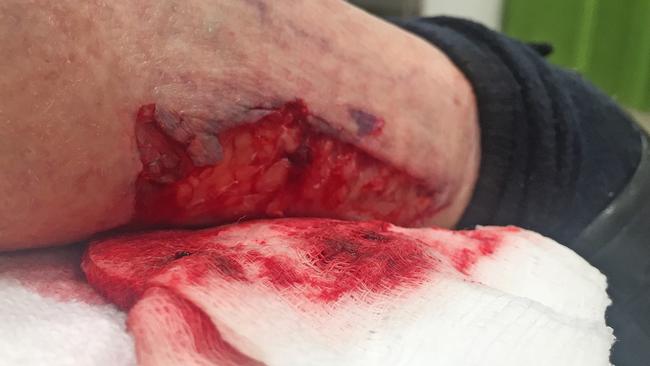 The 78-year-old woman’s injured leg. Picture: Supplied