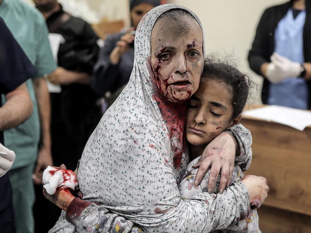 An injured Palestinian woman covered in dust and blood hugs an injured girl child at the hospital following the Israeli bombardment of Khan Yunis in the southern Gaza Strip on November 15, 2023. Picture: AFP.