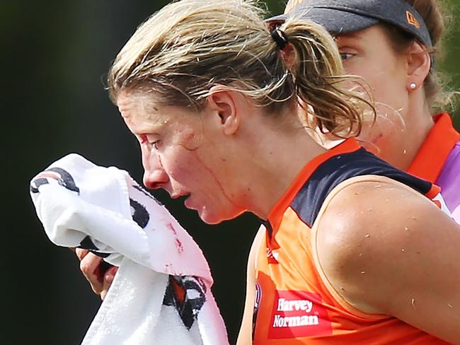 MELBOURNE, AUSTRALIA - FEBRUARY 18:  Cora Staunton of GWS comes off with a facial injury after trying to tackle Sophie Casey of the Magpies during the round three AFLW match between the Collingwood Magpies and the Greater Western Sydney Giants at Olympic Park on February 18, 2018 in Melbourne, Australia.  (Photo by Michael Dodge/Getty Images)