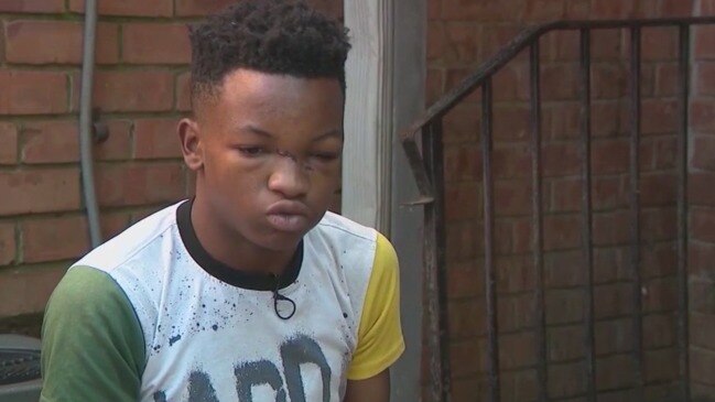 Lawsuit claims apartment management didn’t keep child safe