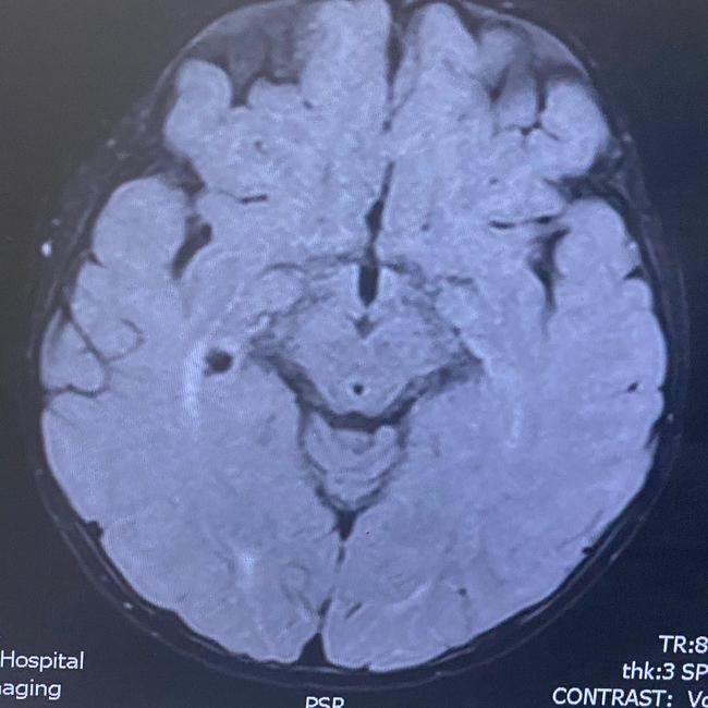 A mass has been detected on Hunter Tween’s brain. Mother Lynda Armstrong said a biopsy comes with a risk of 50 per cent vision loss, massive haemorrhage or death. Picture: Supplied