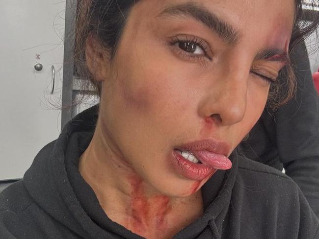 Chopra’s character certainly appears to run into some troubles, if this photo the actress shared is any indication.