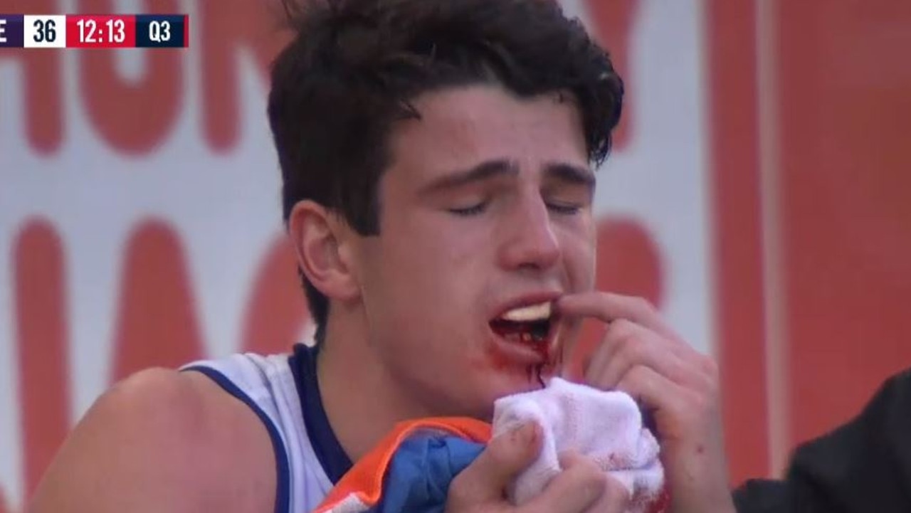 Fremantle Docker Andrew Brayshaw points to his teeth after being hit by Andrew Gaff in Round 20.