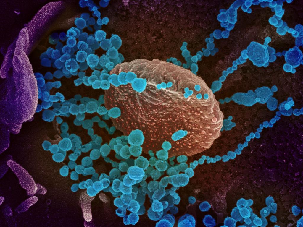 A scanning electron microscope image of SARS-CoV-2 (round blue objects) emerging from the surface of cells cultured in the lab, SARS-CoV-2, also known as 2019-nCoV, is the virus that causes COVID-19, the virus shown was isolated from a patient in the US.