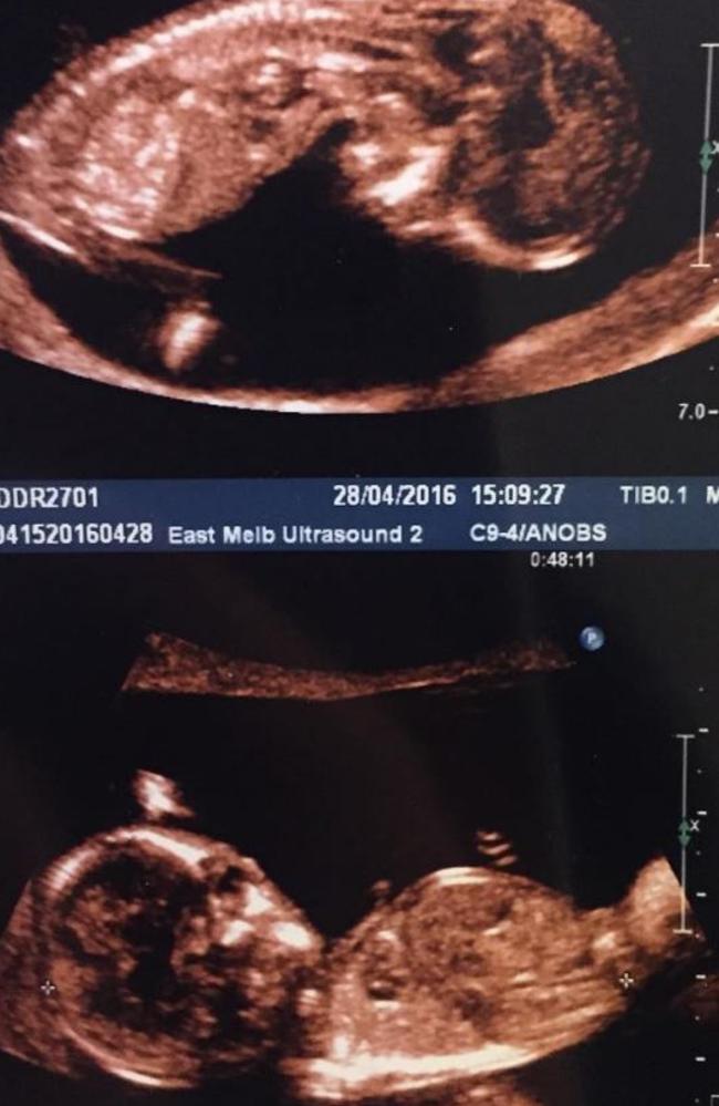 Little newbies. Picture: Instagram.