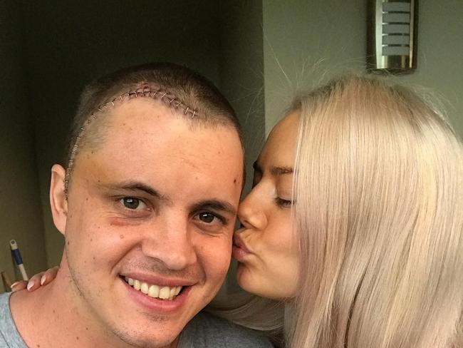 His girlfriend Tahnee has remained by his side throughout his cancer journey.