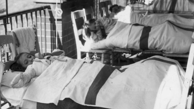 Children with polio lie on chairs in the overcrowded Children’s Hospital, Camperdown.