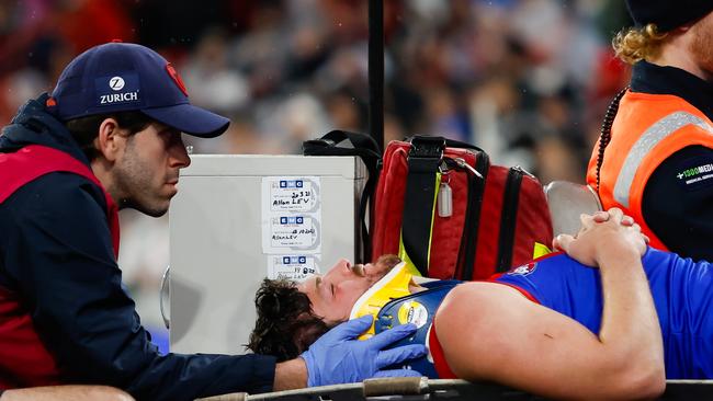 Angus Brayshaw leaves the field on a stretcher during the 2023 AFL First Qualifying Final match between Collingwood and Melbourne. Picture: Dylan Burns/AFL Photos via Getty Images.