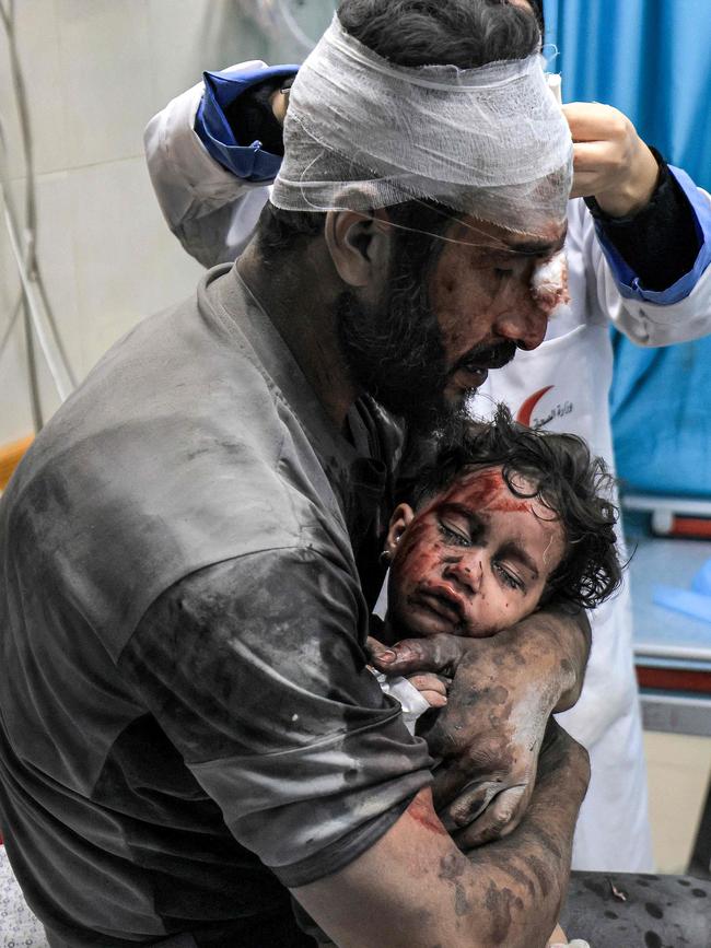 An injured man holds an injured child, both survivors of Israeli bombardment, at Nasser hospital in Khan Yunis in the southern Gaza Strip on October 24. Picture: Mahmud Hams/ AFP