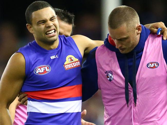 MELBOURNE, VICTORIA - APRIL 16: Jason Johannisen of the Bulldogs leaves the field injured during the round four AFL match between the Carlton Blues and the Western Bulldogs at Etihad Stadium on April 16, 2016 in Melbourne, Australia. (Photo by Scott Barbour/AFL Media/Getty Images)