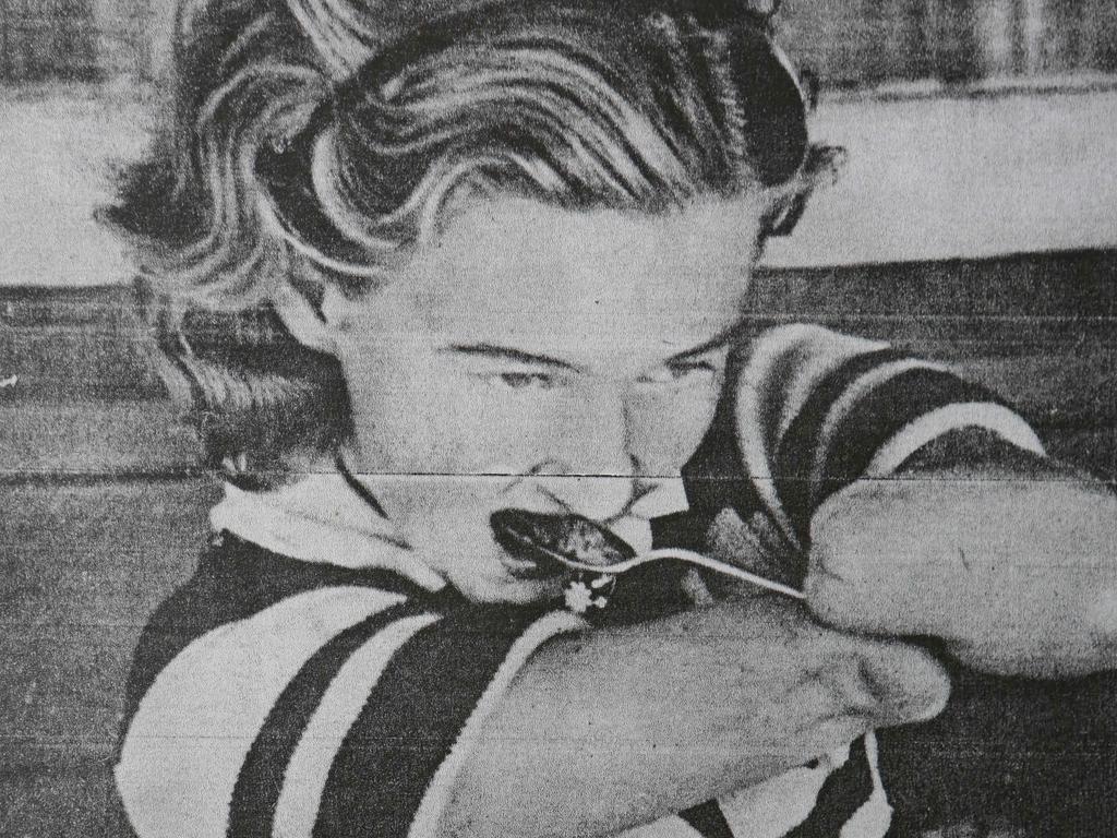 Beryl Morrin as a sixteen year old after having both her hands bitten off by at shark at Chipping Norton Lake.