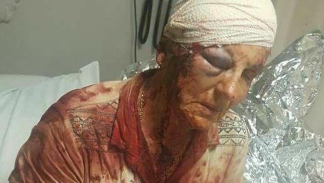 An image of an elderly farm attack victim uploaded to Facebook.