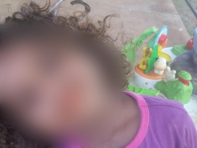 A two-year old girl has been airlifted to hospital in a coma after suffering a suspected severe sexual assault in the Northern Territory town of Tennant Creek.