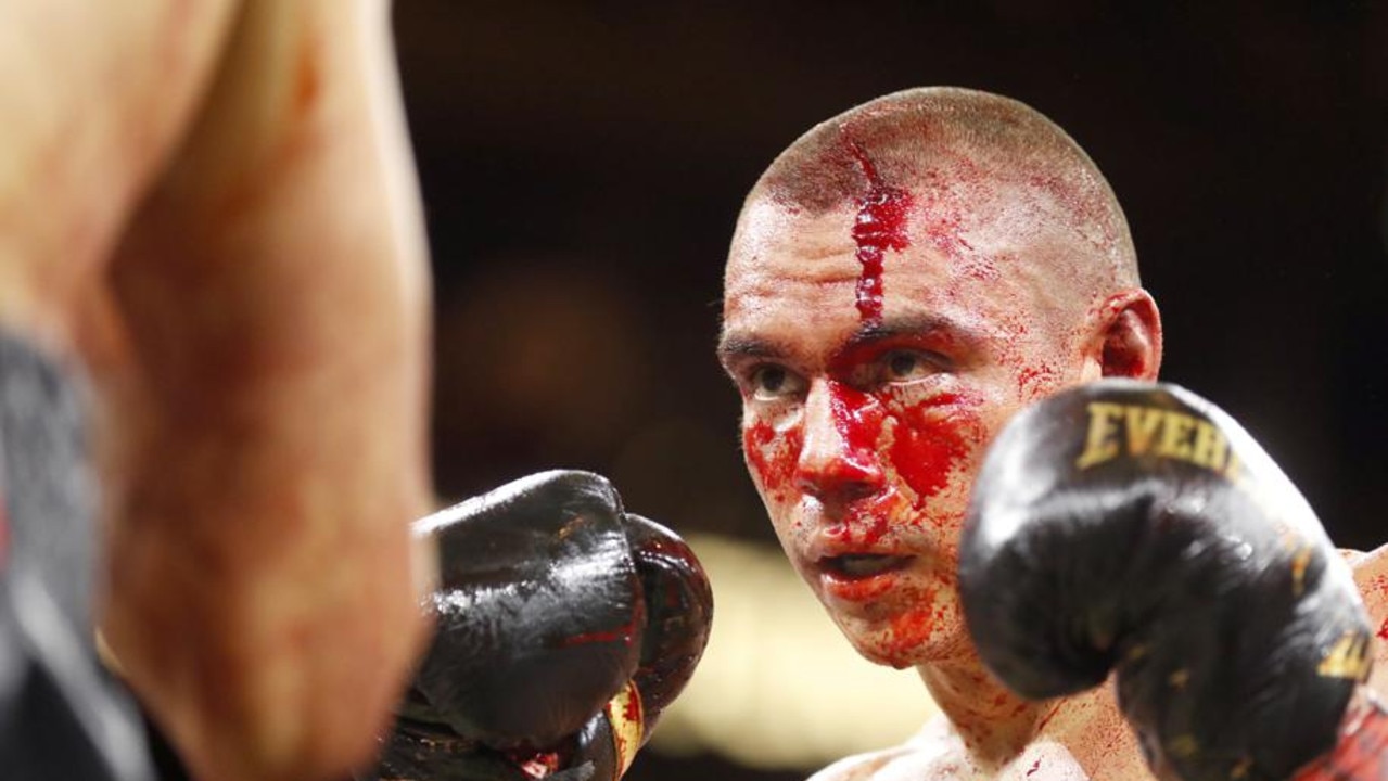 A bloodied Tim Tszyu battles against Sebastian Fundora in Las Vegas, Nevada. (Photo by Steve Marcus/Getty Images)