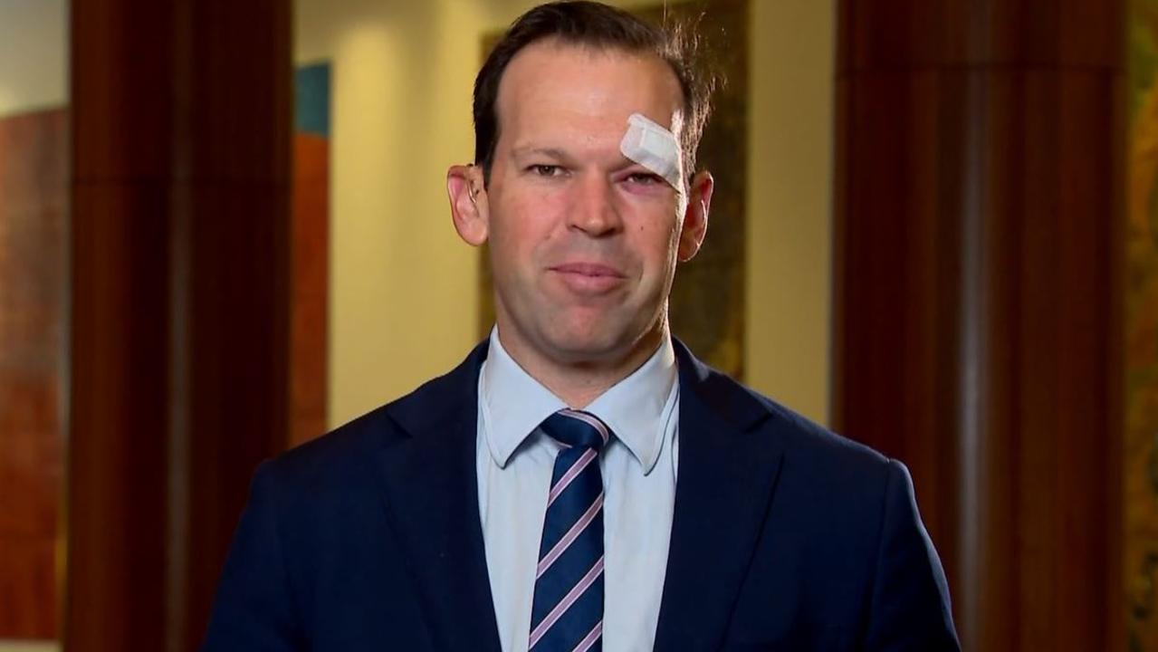 Senator Matt Canavan appeared on Today with a bruised eye. Picture: Today