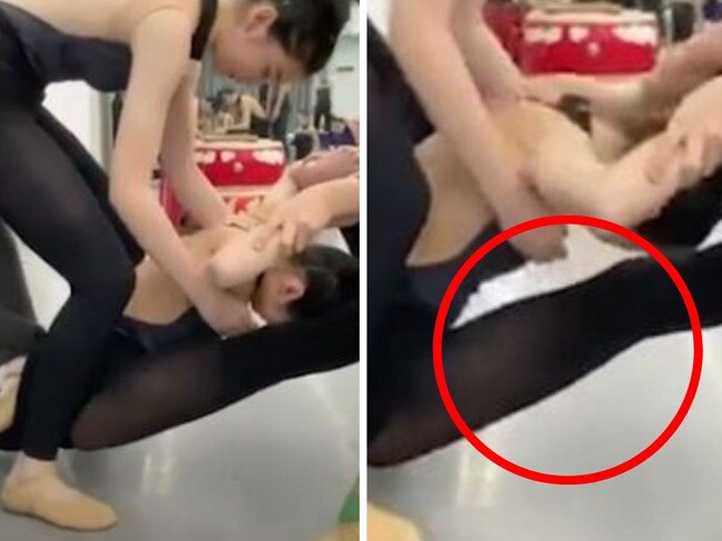 The ballerina snapped her leg during a difficult pose. Picture: Viral Press