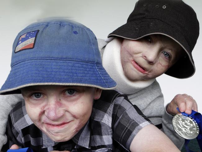 Pride of Australia awards at the Bellerive Century room picture of child of Courage award winners from left Fletcher and Spencer Connelly