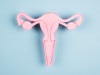 Researchers have found a less invasive method to diagnose endometriosis
