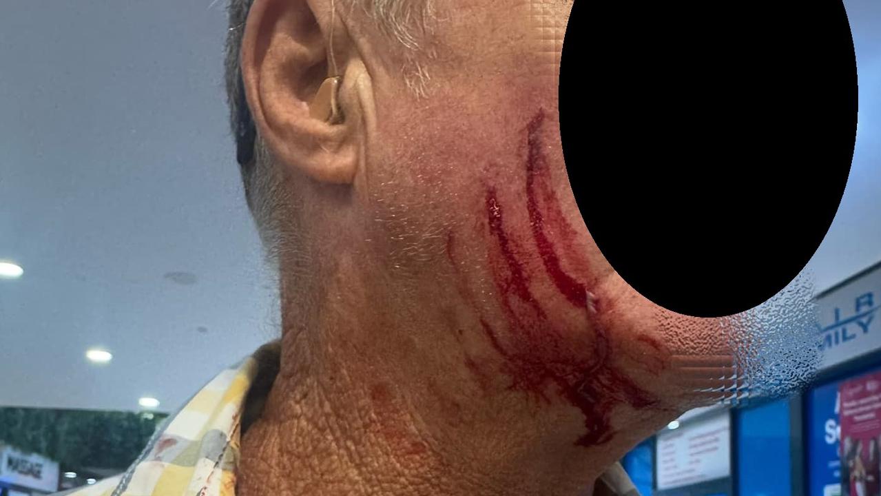 ‘Pulled out small knife’: Senior attacked at GC shop centre