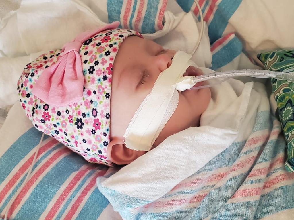 Baby Ellie is starting to show some small signs of improvement. Picture: Facebook/Ashley Hildebrand