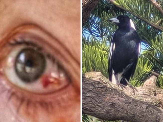 The mum has issued a warning after a horror magpie attack.