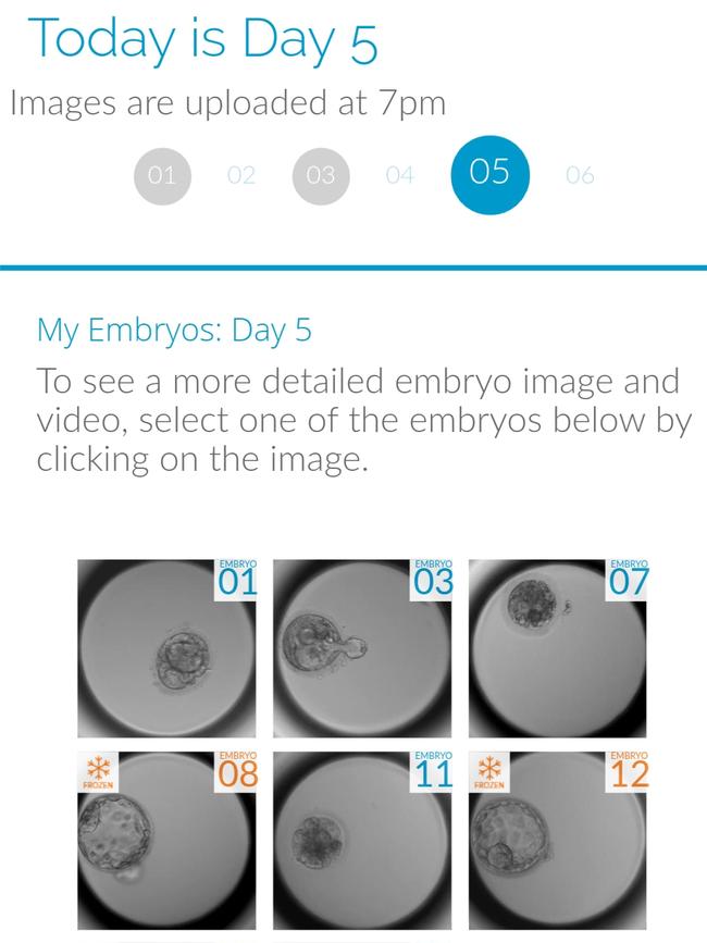 The Genea app has helped the couple track how their embryos grow and they get to watch the process.