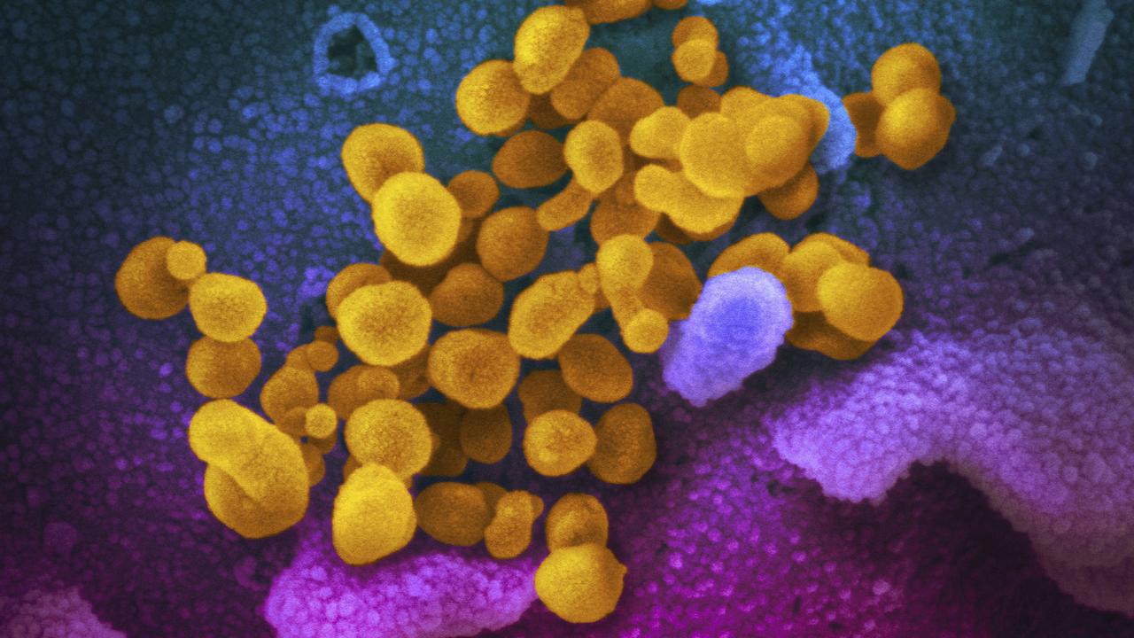 The new coronavirus SARS-CoV-2, yellow, emerging from the surface of cells, blue/pink, cultured in the lab. Picture: AP