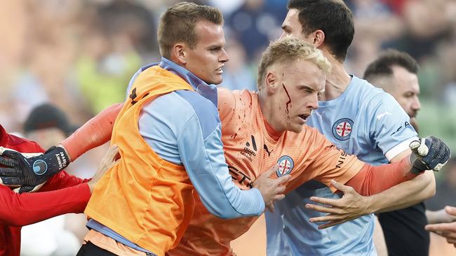 MELBOURNE, AUSTRALIA - DECEMBER 17: A bleeding Tom Glover of Melbourne City is escorted from the pitch by team mates after fans stormed the pitch during the round eight A-League Men's match between Melbourne City and Melbourne Victory at AAMI Park, on December 17, 2022, in Melbourne, Australia. (Photo by Darrian Traynor/Getty Images)