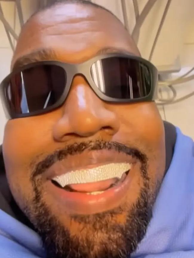 The rapper paid $US850,000 for the prosthodontics done by Dr Thomas Connelly last year. Picture: yeezy.com