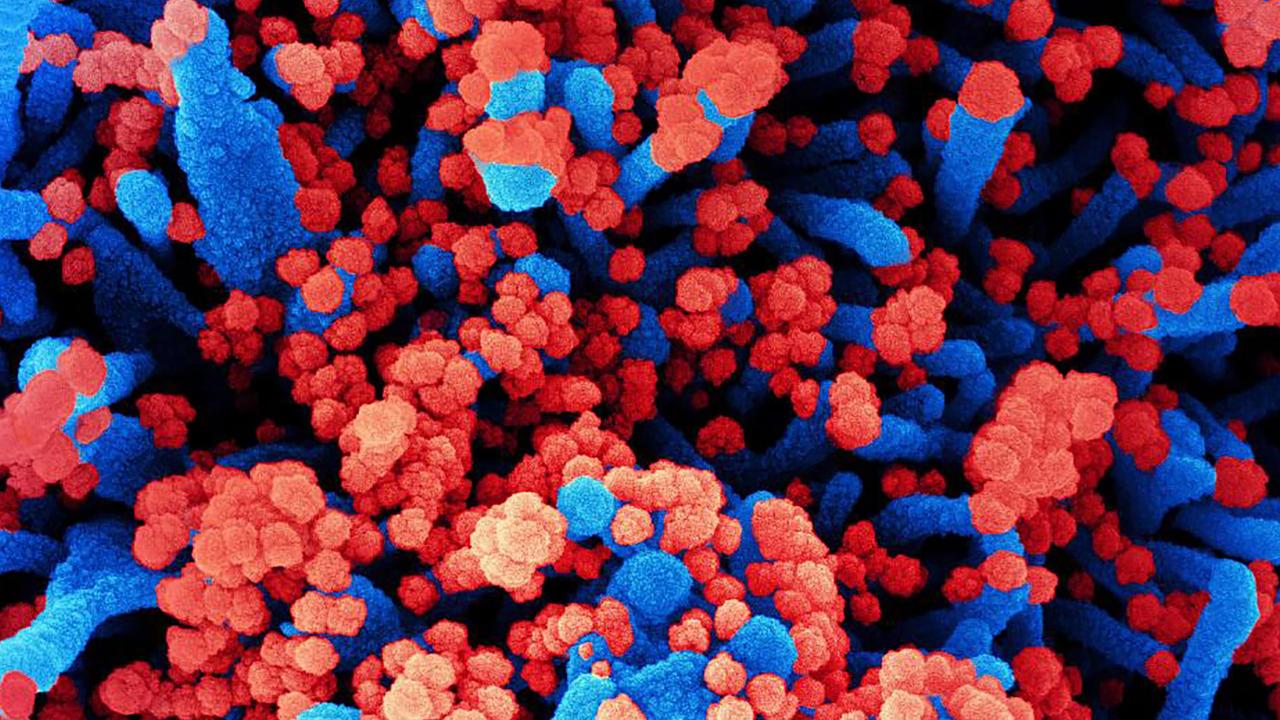 A colourised scanning electron micrograph of a cell (blue) heavily infected with SARS-CoV-2 virus particles (red). Picture: National Institute of Allergy and Infectious Diseases/AFP