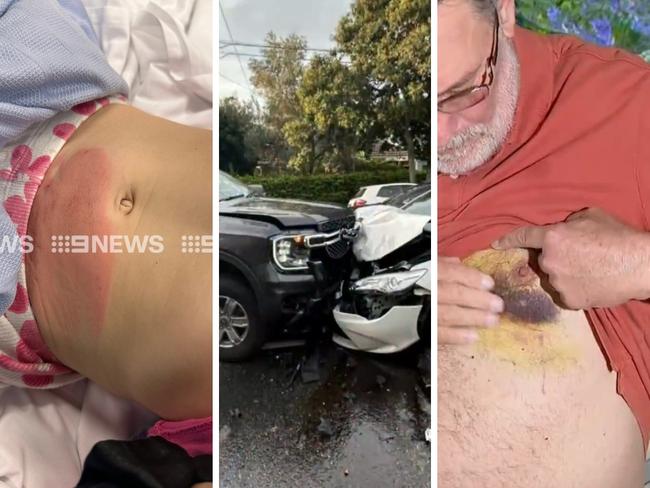 Photos of the injuries have come to light. Photo: 9News Queensland and Twitter, @BaileyKenzie9.