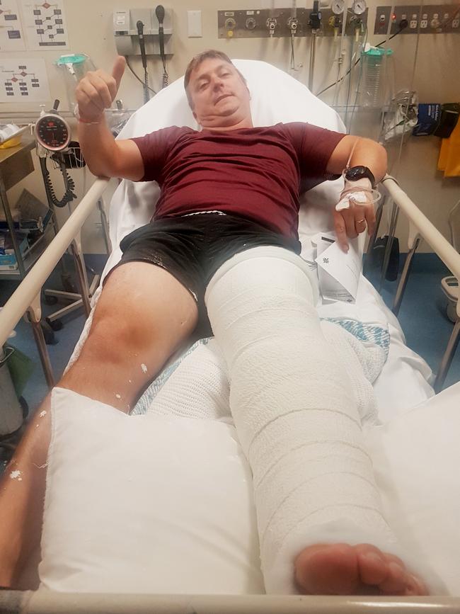 Dan Duncan, 43, broke his leg in three places after coming off the 30m slippery slide at Hilltop Park in Schofields.