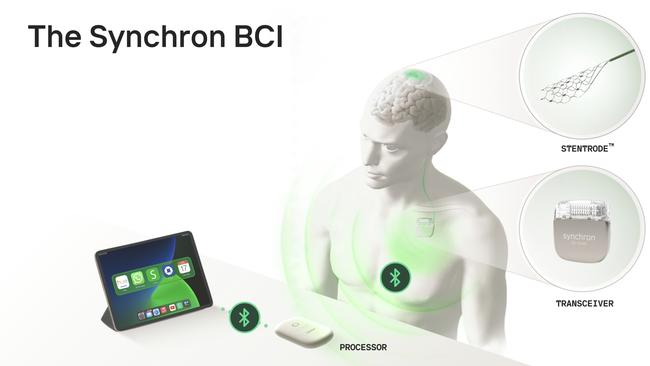 How Synchron's brain computer interface works.