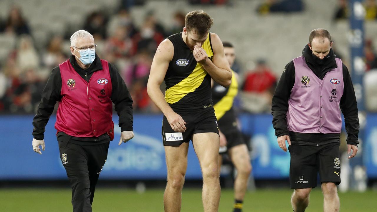 AFL news 2021: Richmond injury list, Noah Balta knee, Nathan Broad syndesmosis, Tigers loss to St Kilda Saints