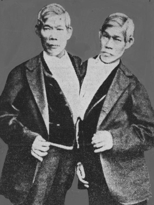 Siamese Twins Eng Bunker and Chang Bunker in 1870.