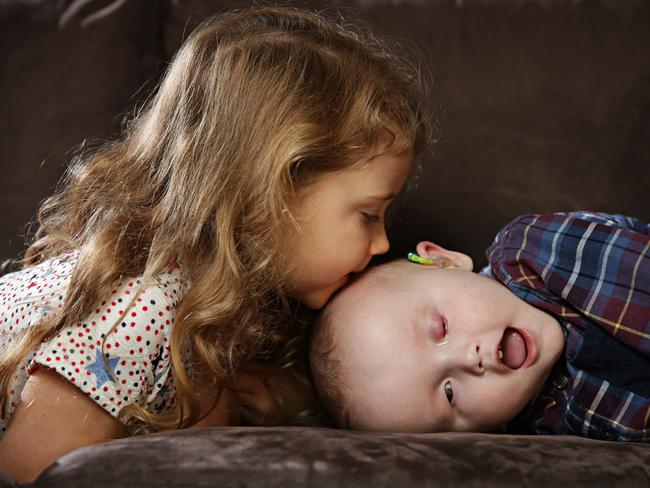 Alba Innes and her brother Archibald ‘Archie’ Innes,  who was born without both eyes, pictured last year. Picture: Adam Yip / Manly Daily