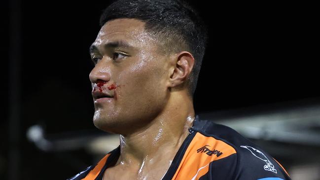 SYDNEY, AUSTRALIA - JULY 06: Stefano Utoikamanu of the Wests Tigers leaves the fiels with a bloody nose and ripped shirt during the round 18 NRL match between Wests Tigers and Melbourne Storm at Leichhardt Oval, on July 06, 2024, in Sydney, Australia. (Photo by Scott Gardiner/Getty Images)