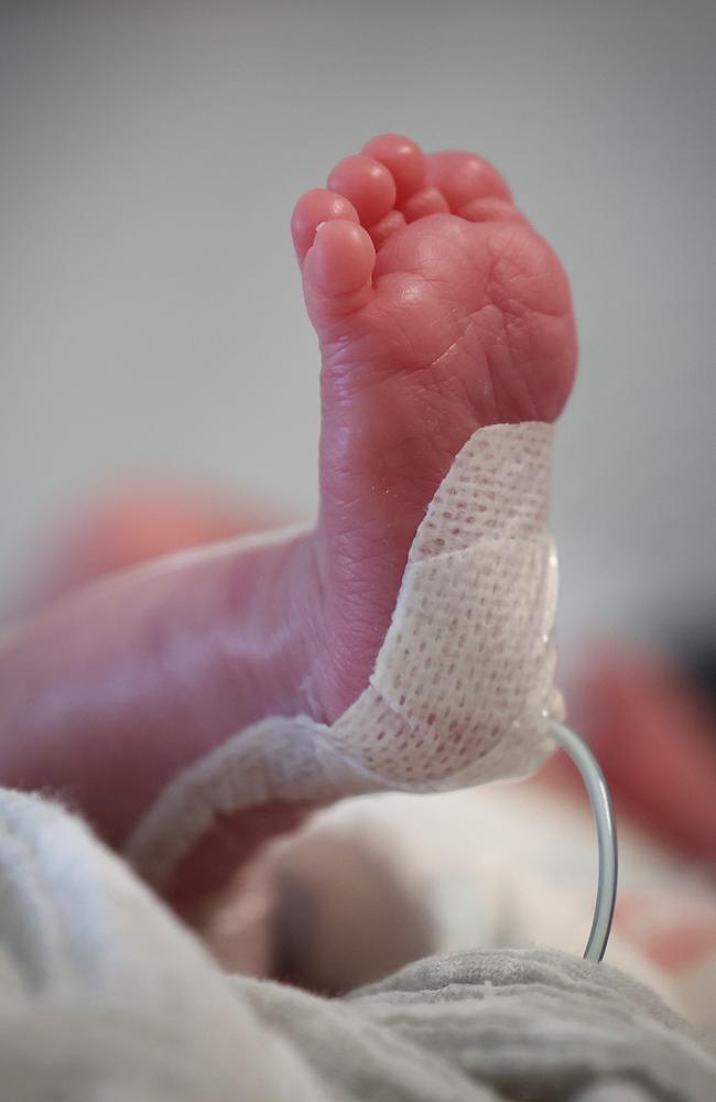 It’s not only premmie babies like George Ford who are being cared for in the unit. Picture: David Caird