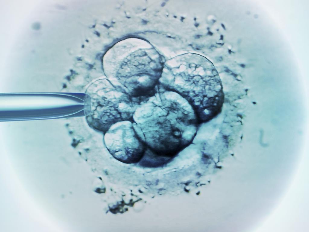 Woman has stranger’s child after IVF error