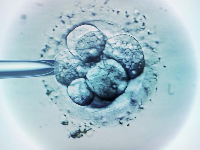 Embryo selection for IVF, light micrograph. Picture: Getty Images