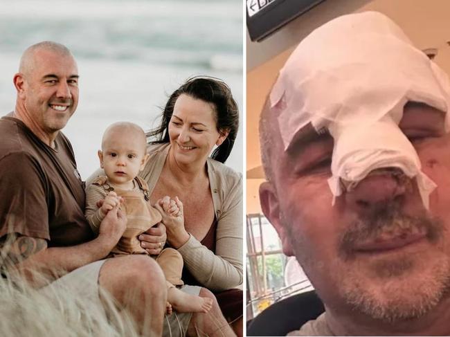 ‘Do or die’: Family’s $30k blow after horror Bali surf injury