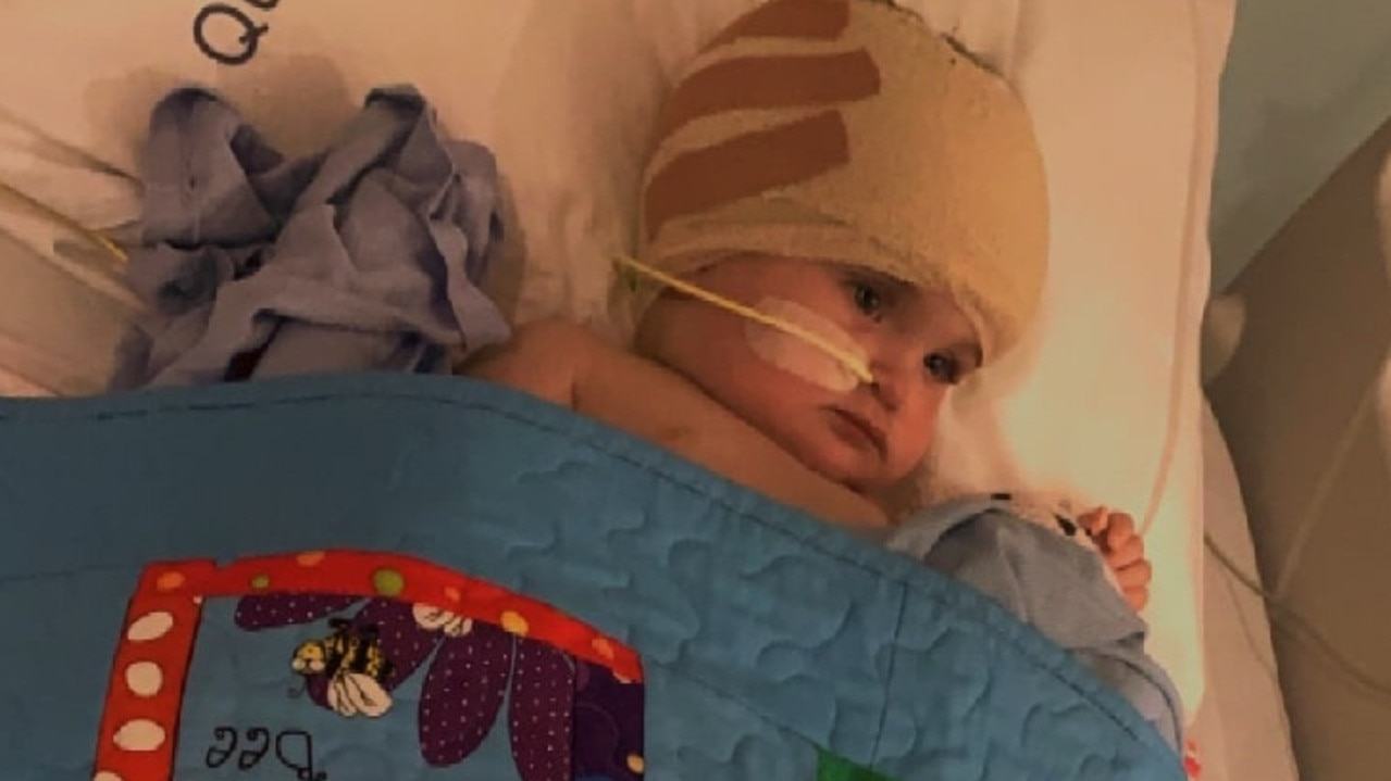 ‘Could fit two hands in her head’: NT toddler’s brain surgery battle